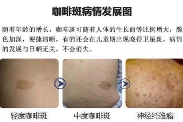 算命胎记