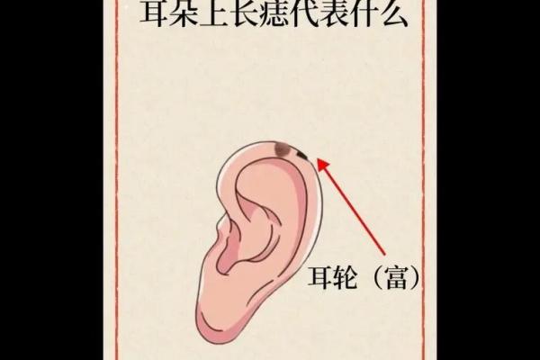 风水上耳朵有痣的人命运