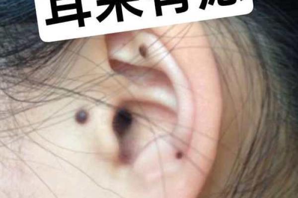 风水上耳朵有痣的人命运