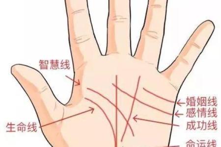 怎么看胎记算命-