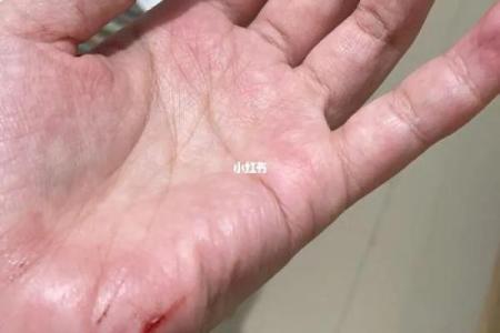 开车摔跤了还能去算命吗