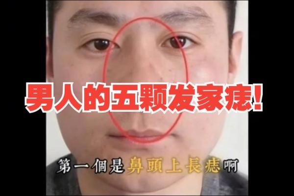男人脸部有痣，算命你运势好坏