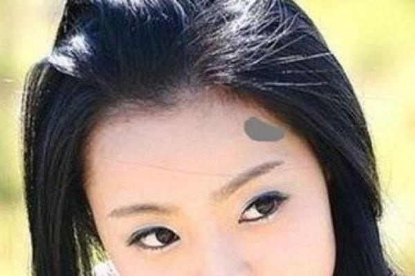 额头胎记算命图解