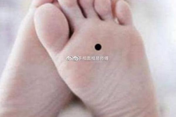 痣相风水脚底有痣的人命运好不好