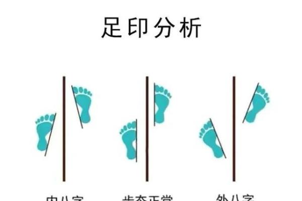 内八字、外八字孩子脚型正常不正常，家长可以这么判断