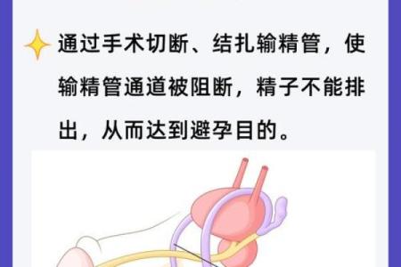 八字结扎
