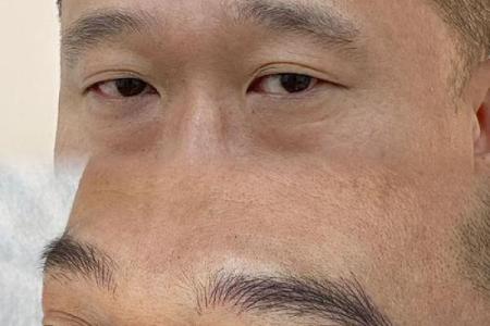 眉心八字纹的男人面相